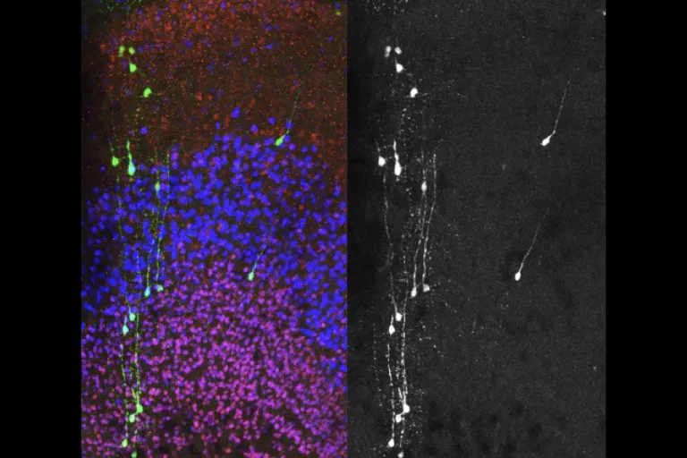 modeling neurodevelopmental disorders