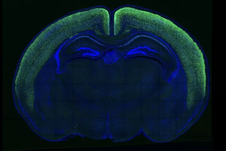 brain slice