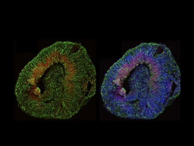 microscopy image