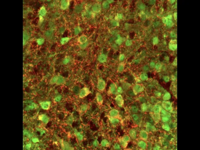 microscopy image